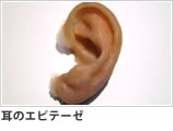 耳のエピテーゼ